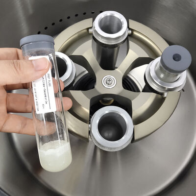 PRP Centrifuge with 5000rpm Max Speed, 3555xg Max RCF, and LCD Display for Clinical Medicine
